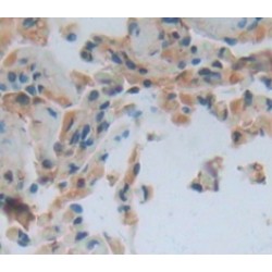 Torsin 2A (TOR2A) Antibody