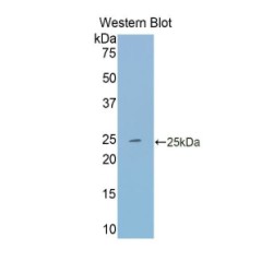 Transferrin (TF) Antibody