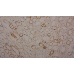 Transferrin (TF) Antibody