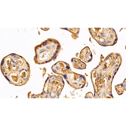 Transferrin (TF) Antibody