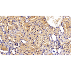 Transferrin (TF) Antibody