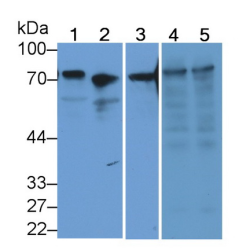 Transferrin (TF) Antibody