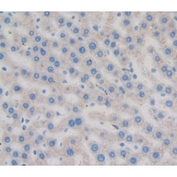 Transferrin (TF) Antibody