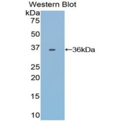 Transferrin (TF) Antibody