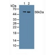 Western blot analysis of (1) Human Urine and (2) Human Serum.