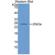 Western blot analysis of the recombinant protein.
