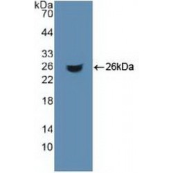 Aconitase 1 (ACO1) Antibody