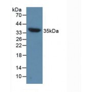 Western blot analysis of Mouse Heart Tissue.
