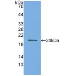 Aquaporin 4 (AQP4) Antibody