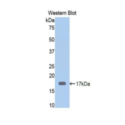 Calreticulin (CALR) Antibody