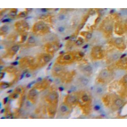 Calreticulin (CALR) Antibody