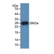 Western blot analysis of recombinant Mouse CTSB.