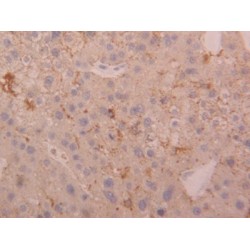 Cathepsin D (CTSD) Antibody