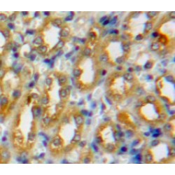 Cathepsin D (CTSD) Antibody