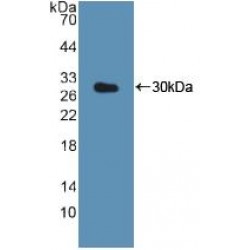 Cathepsin K (CTSK) Antibody