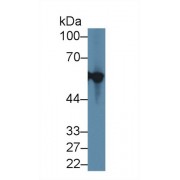 Western blot analysis of Human WERI-Rb-1 cell lysate, using Rat KRT12 Antibody (1 µg/ml) and HRP-conjugated Goat Anti-Rabbit antibody (<a href="https://www.abbexa.com/index.php?route=product/search&amp;search=abx400043" target="_blank">abx400043</a>, 0.2 µg/ml).
