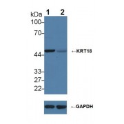 Western blot analysis of (1) Wild-type HeLa cell lysate, and (2) KRT18 knockout HeLa cell lysate, using Rabbit Anti-Human KRT18 Antibody (2 µg/ml) and HRP-conjugated Goat Anti-Mouse antibody (<a href="https://www.abbexa.com/index.php?route=product/search&amp;search=abx400001" target="_blank">abx400001</a>, 0.2 µg/ml).