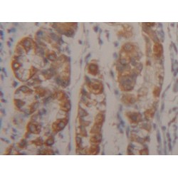 Keratin 18 (KRT18) Antibody
