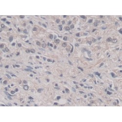 Pepsinogen C (PGC) Antibody