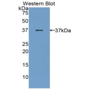 Western blot analysis of the recombinant protein.