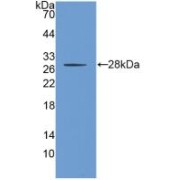 abx100857