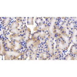 Prominin-1 (PROM1) Antibody