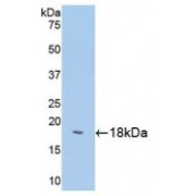 Western blot analysis of recombinant Human SST protein.