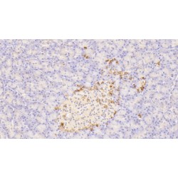 Somatostatin (SST) Antibody