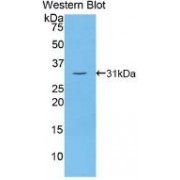 Western blot analysis of recombinant Human Thyroglobulin.