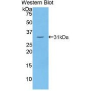 Western blot analysis of recombinant Human Thyroglobulin.