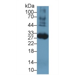 Tissue Factor (F3) Antibody