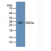 Western blot analysis of Rabbit Brain Tissue.