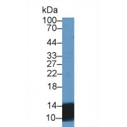 Western blot analysis of Human Urine, using Human UCN2 Antibody (2 µg/ml) and HRP-conjugated Goat Anti-Rabbit antibody (<a href="https://www.abbexa.com/index.php?route=product/search&amp;search=abx400043" target="_blank">abx400043</a>, 0.2 µg/ml).