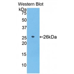 Azurocidin 1 (AZU1) Antibody