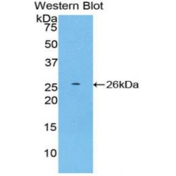 Protein SCAF11 (SCAF11) Antibody