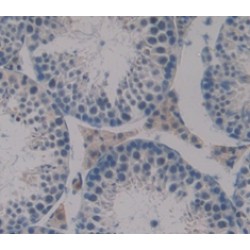 Dermatopontin (DPT) Antibody