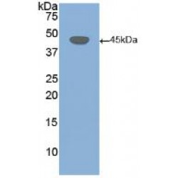 Desmoglein 3 (DSG3) Antibody