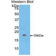 Western blot analysis of recombinant Human HBm Protein.