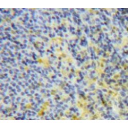 Interleukin 6 (IL6) Antibody