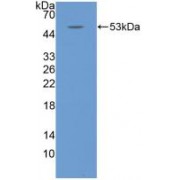 Western blot analysis of recombinant Rabbit IL6.