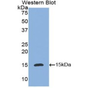 abx100960