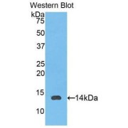 abx100965
