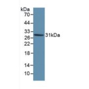 Western blot analysis of recombinant Human KLK1.