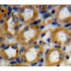 Kallikrein 1 (KLK1) Antibody