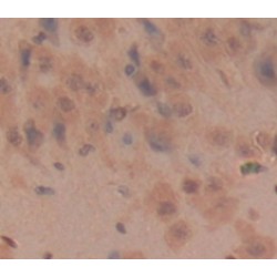 Kallikrein 6 (KLK6) Antibody