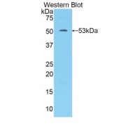 Western blot analysis of recombinant Human KLK7.