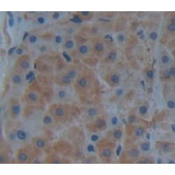 Kallikrein 7 (KLK7) Antibody