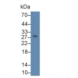 Kallikrein 7 (KLK7) Antibody