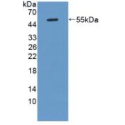 Western blot analysis of recombinant Rat KLK8.