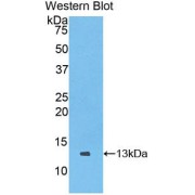 Western blot analysis of the recombinant protein.